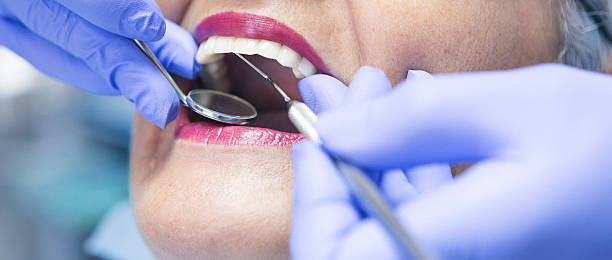 Best Emergency Wisdom Teeth Removal in Harwich Port, MA
